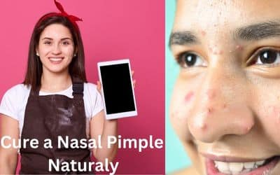 How To Cure a Nasal Pimple Quickly and Naturally