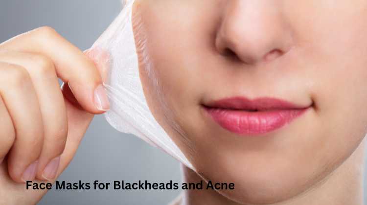 Face Masks for Blackheads and Acne